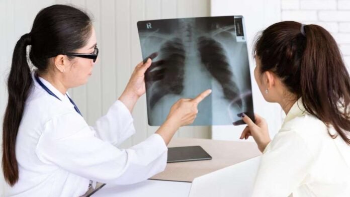 World Tuberculosis Day 2025: Experts share diagnosis, treatment options for the contagious disease