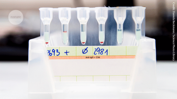 <p>Home medical tests, also known as self-tests or over-the-counter (OTC) tests, have become increasingly popular in recent years. While they can be convenient and provide quick results, they are not always accurate or reliable. Here are some reasons why home medical tests may miss the mark:</p>
<ol>
<li><strong>Lack of regulation</strong>: The regulation of home medical tests is often less stringent than that of laboratory tests. This can lead to variations in test quality and accuracy.</li>
<li><strong>Insufficient validation</strong>: Many home medical tests have not been thoroughly validated for accuracy and reliability. This can result in false positive or false negative results.</li>
<li><strong>User error</strong>: Home medical tests require users to follow instructions carefully, which can be a source of error. Incorrect specimen collection, handling, or test performance can lead to inaccurate results.</li>
<li><strong>Limited sensitivity and specificity</strong>: Home medical tests may not be as sensitive or specific as laboratory tests, which can lead to false negative or false positive results.</li>
<li><strong>Interpretation of results</strong>: Home medical tests often provide simple "yes/no" or "positive/negative" results, which can be misleading or difficult to interpret without medical expertise.</li>
<li><strong>Lack of standardization</strong>: Home medical tests may not be standardized, which can make it difficult to compare results across different tests or manufacturers.</li>
<li><strong>Limited detection of conditions</strong>: Home medical tests may not be able to detect all conditions or diseases, which can lead to false reassurance or delayed diagnosis.</li>
</ol>
<p>Examples of home medical tests that may miss the mark include:</p>
<ol>
<li><strong>COVID-19 rapid tests</strong>: While convenient, these tests have been shown to have lower sensitivity and specificity than laboratory-based PCR tests.</li>
<li><strong>Pregnancy tests</strong>: False negative results can occur if the test is taken too early or if the user has a low level of human chorionic gonadotropin (hCG).</li>
<li><strong>Food sensitivity tests</strong>: These tests have been criticized for their lack of scientific evidence and potential for false positive results.</li>
<li><strong> Blood glucose monitors</strong>: While generally accurate, these devices can be affected by user error, calibration issues, or interference from other factors.</li>
</ol>
<p>To ensure accurate and reliable results, it's essential to:</p>
<ol>
<li><strong>Consult with a healthcare professional</strong>: Before using a home medical test, consult with a healthcare professional to determine the best test for your needs and to discuss any concerns or questions.</li>
<li><strong>Follow instructions carefully</strong>: Read and follow the test instructions carefully to minimize user error.</li>
<li><strong>Understand the limitations</strong>: Be aware of the limitations and potential pitfalls of home medical tests, including the risk of false positive or false negative results.</li>
<li><strong>Verify results with a healthcare professional</strong>: If you receive a positive or concerning result, verify it with a healthcare professional to confirm the diagnosis and develop a treatment plan.</li>
</ol>
<p>Remember, home medical tests should not replace medical consultations or laboratory tests. If you have concerns about your health, it's always best to consult with a healthcare professional.</p>