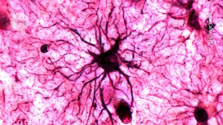 <p>Emotional memories are a complex and fascinating topic! The process of how they are engraved on the brain involves a network of brain regions, cells, and molecules that work together to consolidate and store emotional experiences. Let's dive into the details!</p>
<p><strong>The Emotional Memory Pathway</strong></p>
<p>When we experience an emotionally charged event, such as a traumatic accident or a joyful celebration, the brain's emotional centers are activated. The emotional memory pathway involves the following key brain regions:</p>
<ol>
<li><strong>Amygdala</strong>: The amygdala is a small almond-shaped structure in the temporal lobe that processes emotions, such as fear, anxiety, and happiness. It's like the brain's "emotional alarm system."</li>
<li><strong>Hippocampus</strong>: The hippocampus, located in the temporal lobe, plays a crucial role in forming and storing new memories, including emotional ones. It's involved in the consolidation of information from short-term to long-term memory.</li>
<li><strong>Prefrontal cortex</strong>: The prefrontal cortex, located in the frontal lobe, is responsible for decision-making, planning, and regulating emotions. It helps to evaluate the emotional significance of an event and integrate it into our existing knowledge and experiences.</li>
</ol>
<p><strong>The Role of Neurotransmitters and Hormones</strong></p>
<p>Neurotransmitters, such as dopamine, serotonin, and norepinephrine, play important roles in modulating emotional experiences and memory formation. Hormones, like adrenaline (also known as epinephrine) and cortisol, are also released in response to emotional events, influencing the consolidation of emotional memories.</p>
<p><strong>Helper Cells: Microglia and Astrocytes</strong></p>
<p>Now, let's talk about the surprising helper cells that contribute to emotional memory formation: microglia and astrocytes. These glial cells, which were once thought to be merely support cells, have been found to play active roles in shaping emotional memories.</p>
<ol>
<li><strong>Microglia</strong>: Microglia are the brain's immune cells, responsible for clearing debris and infections. Recent studies have shown that microglia also influence emotional memory formation by regulating the strength and connectivity of synaptic connections between neurons. They can even promote the growth of new neurons in the hippocampus, which is essential for memory formation.</li>
<li><strong>Astrocytes</strong>: Astrocytes are star-shaped glial cells that provide nutrients and support to neurons. They also play a crucial role in modulating synaptic transmission and plasticity, which are essential for learning and memory. Astrocytes can release chemical signals that influence the strength of neural connections, thereby shaping emotional memories.</li>
</ol>
<p><strong>How Emotional Memories are Engraved</strong></p>
<p>When an emotionally charged event occurs, the following sequence of events unfolds:</p>
<ol>
<li><strong>Sensory input</strong>: The brain receives sensory information about the event, which is processed by the thalamus and other sensory cortices.</li>
<li><strong>Emotional evaluation</strong>: The amygdala evaluates the emotional significance of the event, releasing neurotransmitters and hormones that enhance the emotional experience.</li>
<li><strong>Memory consolidation</strong>: The hippocampus and prefrontal cortex work together to consolidate the emotional memory, integrating it into our existing knowledge and experiences.</li>
<li><strong>Microglia and astrocyte activation</strong>: Microglia and astrocytes are activated, regulating synaptic connections and promoting the growth of new neurons, which helps to solidify the emotional memory.</li>
</ol>
<p><strong>Surprising Consequences</strong></p>
<p>The involvement of microglia and astrocytes in emotional memory formation has surprising consequences, such as:</p>
<ol>
<li><strong>Emotional memories can be updated or revised</strong>: Microglia and astrocytes can rewire neural connections, allowing emotional memories to be updated or revised based on new experiences.</li>
<li><strong>Emotional memories can influence behavior</strong>: The strength and connectivity of neural connections, shaped by microglia and astrocytes, can influence our behavior and decision-making, especially in response to emotional stimuli.</li>
</ol>
<p>In conclusion, emotional memories are engraved on the brain through a complex interplay of brain regions, cells, and molecules. The surprising helper cells, microglia and astrocytes, play critical roles in shaping emotional memories, and their dysregulation has been implicated in various neurological and psychiatric disorders, such as anxiety, depression, and post-traumatic stress disorder (PTSD).</p>