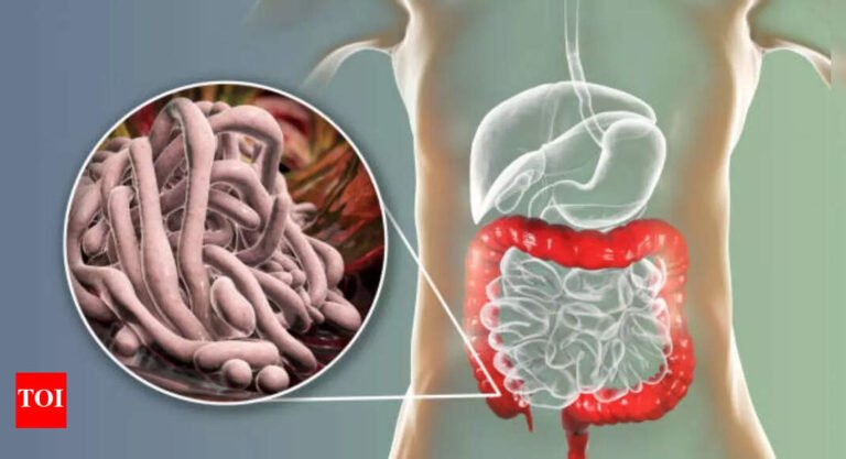 Intestinal Parasites Symptoms: Do you have intestinal parasites? Gastroenterologist shares common symptoms to be aware of |