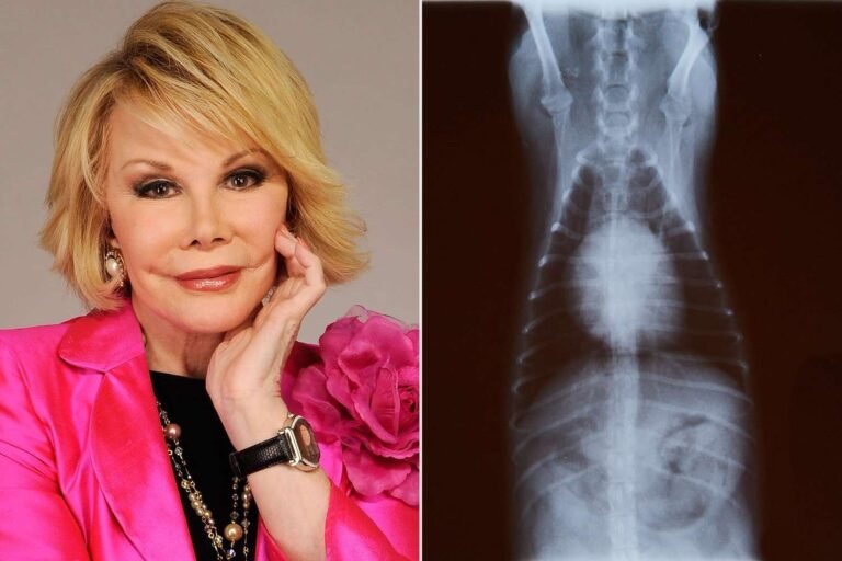 It appears that some unique and intriguing items are being auctioned off. Joan Rivers' wigs, specifically her Shag wigs, are among the items up for auction. These wigs likely hold sentimental value for fans of the late comedian and fashion icon.

In addition to the wigs, dog X-rays are also being auctioned. This is an unusual item, and it's unclear what the significance of these X-rays might be. Are they from a specific breed or a notable canine? More information would be needed to understand the context and value of these X-rays.

The Royal Family keepsakes being auctioned off could potentially be highly valuable and sought after by collectors. These items might include personal belongings, letters, or other memorabilia related to the British monarchy. The provenance and rarity of these items would significantly impact their value.

To better understand the significance and potential value of these items, could you provide more context or information about the auction, such as the auction house hosting the event, the estimated value of the items, or any notable bidders?